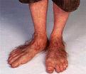 Click image for larger version

Name:	feet.jpg
Views:	1
Size:	26.6 KB
ID:	1156579